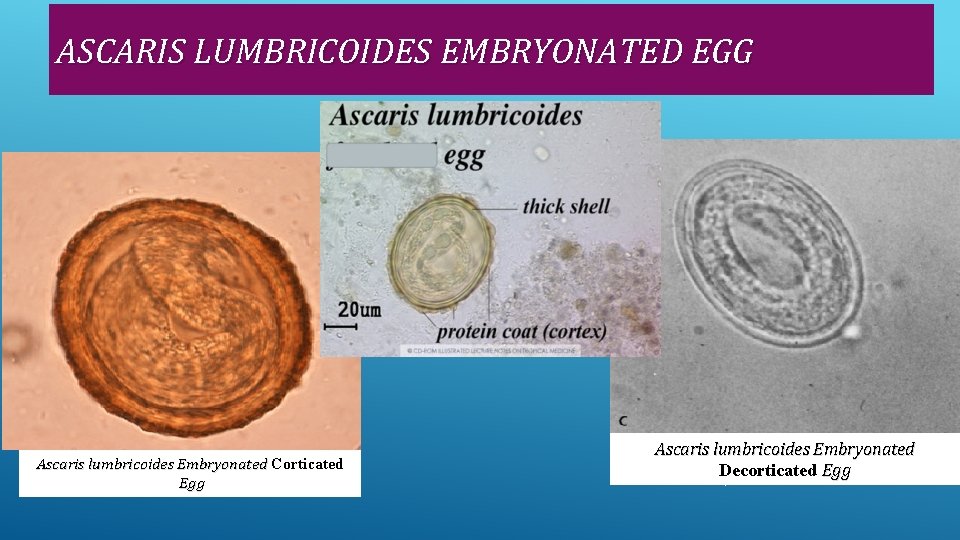 ASCARIS LUMBRICOIDES EMBRYONATED EGG Ascaris lumbricoides Embryonated Corticated Egg Ascaris lumbricoides Embryonated Decorticated Egg