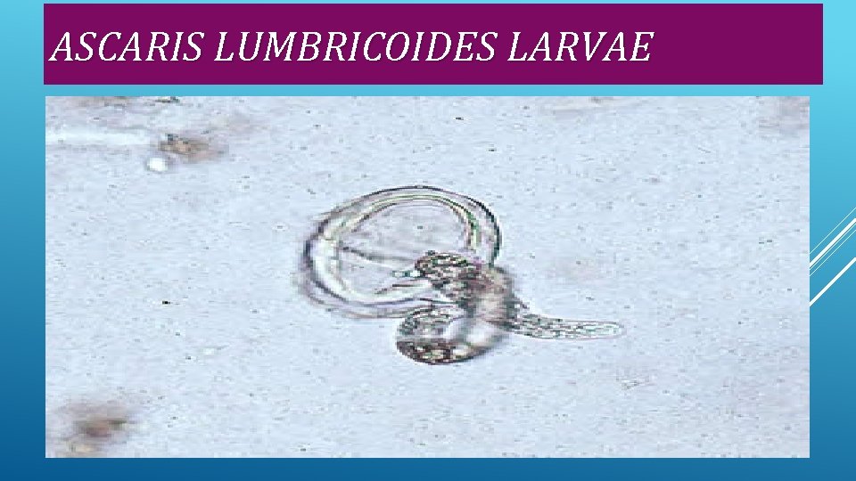 ASCARIS LUMBRICOIDES LARVAE 