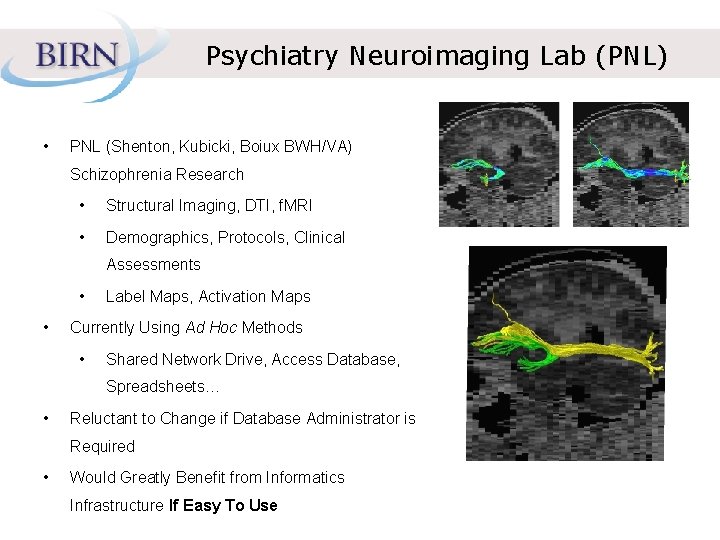 Psychiatry Neuroimaging Lab (PNL) • PNL (Shenton, Kubicki, Boiux BWH/VA) Schizophrenia Research • Structural