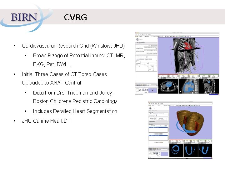 CVRG • Cardiovascular Research Grid (Winslow, JHU) • Broad Range of Potential inputs: CT,