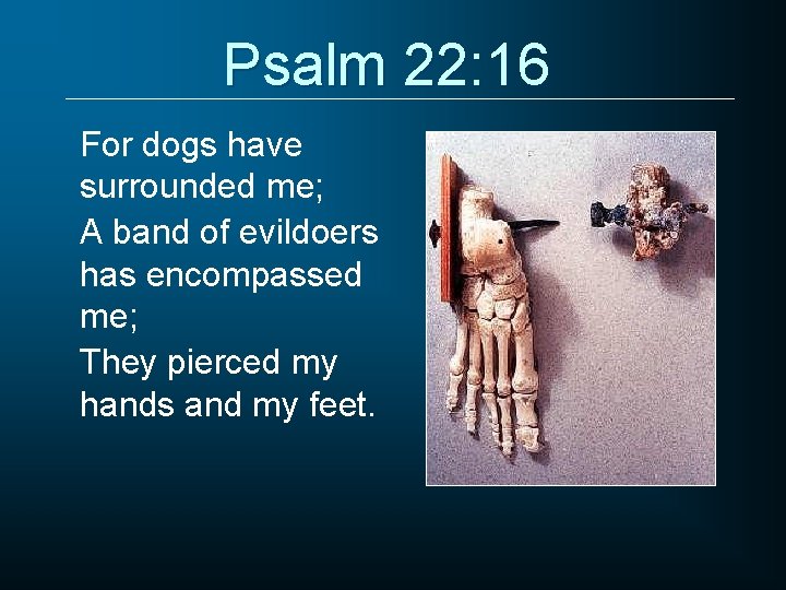 Psalm 22: 16 For dogs have surrounded me; A band of evildoers has encompassed