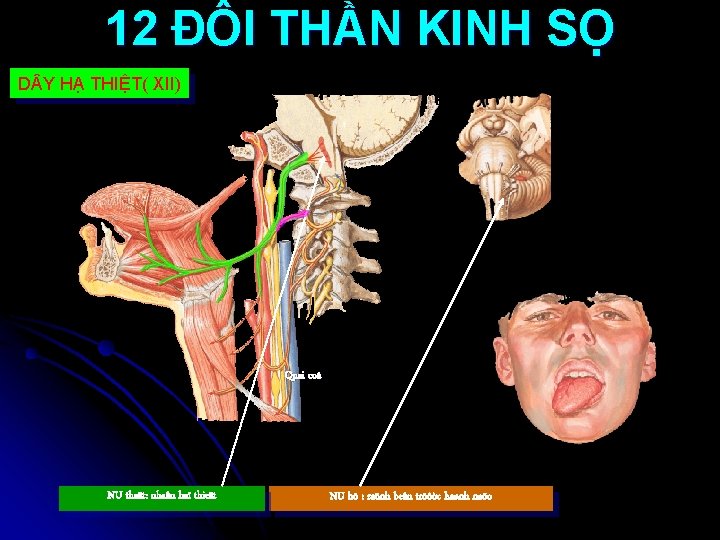 12 ĐÔI THẦN KINH SỌ D Y HẠ THIỆT( XII) Quai coå NU thaät: