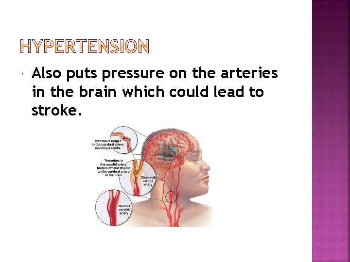  Also puts pressure on the arteries in the brain which could lead to