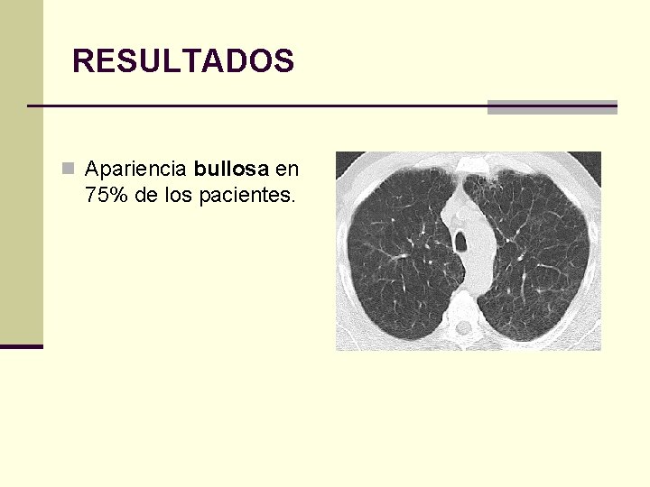 RESULTADOS n Apariencia bullosa en 75% de los pacientes. 