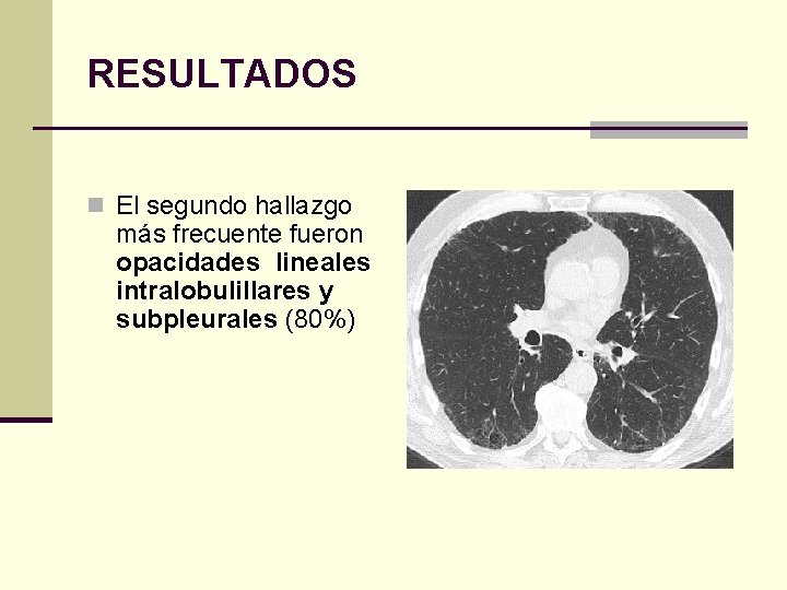 RESULTADOS n El segundo hallazgo más frecuente fueron opacidades lineales intralobulillares y subpleurales (80%)