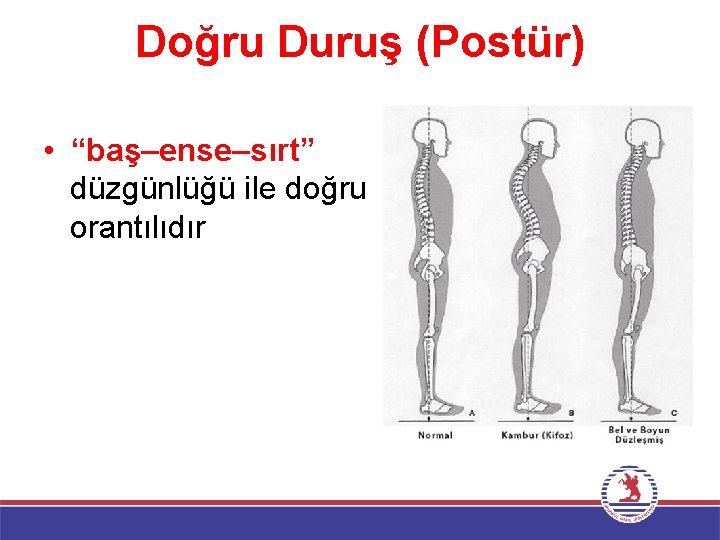 Doğru Duruş (Postür) • “baş–ense–sırt” düzgünlüğü ile doğru orantılıdır 