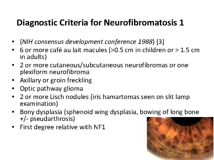 Diagnostic Criteria for Neurofibromatosis 1 • (NIH consensus development conference 1988) [3] • 6