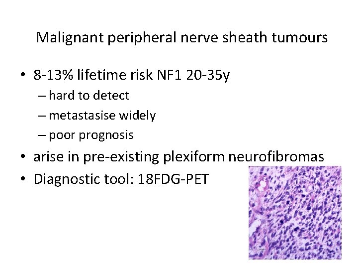 Malignant peripheral nerve sheath tumours • 8 -13% lifetime risk NF 1 20 -35