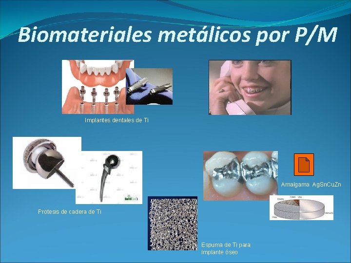 Biomateriales metálicos por P/M Implantes dentales de Ti Amalgama Ag. Sn. Cu. Zn Prótesis