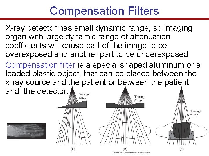 Compensation Filters X-ray detector has small dynamic range, so imaging organ with large dynamic Compensation Filters X-ray detector has small dynamic range, so imaging organ with large dynamic