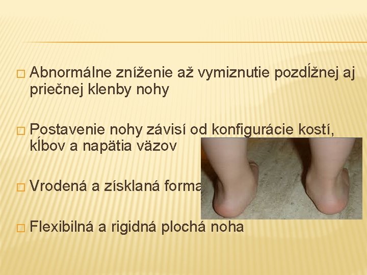 � Abnormálne zníženie až vymiznutie pozdĺžnej aj priečnej klenby nohy � Postavenie nohy závisí