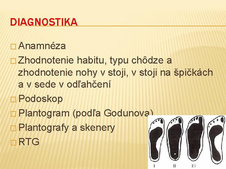 DIAGNOSTIKA � Anamnéza � Zhodnotenie habitu, typu chôdze a zhodnotenie nohy v stoji, v