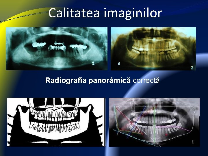 Calitatea imaginilor Radiografía panorámică correctă 