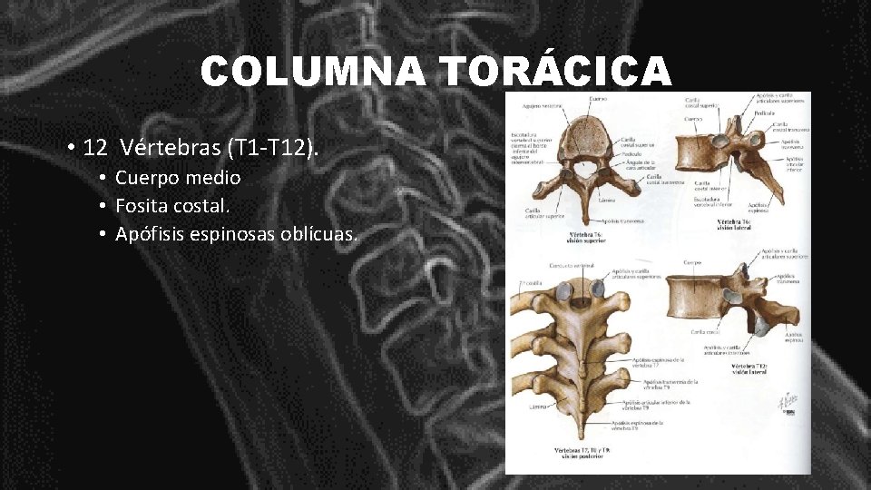 COLUMNA TORÁCICA • 12 Vértebras (T 1 -T 12). • Cuerpo medio • Fosita