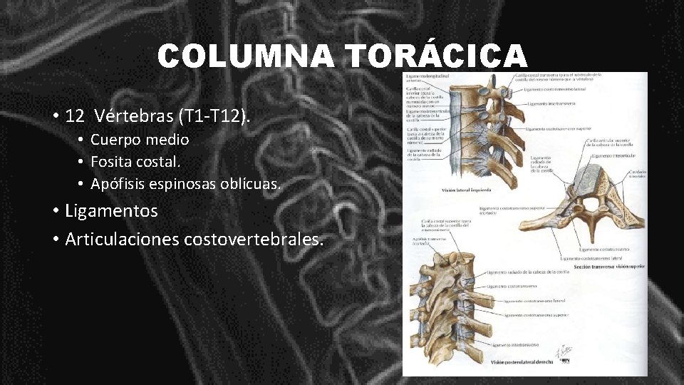 COLUMNA TORÁCICA • 12 Vértebras (T 1 -T 12). • Cuerpo medio • Fosita
