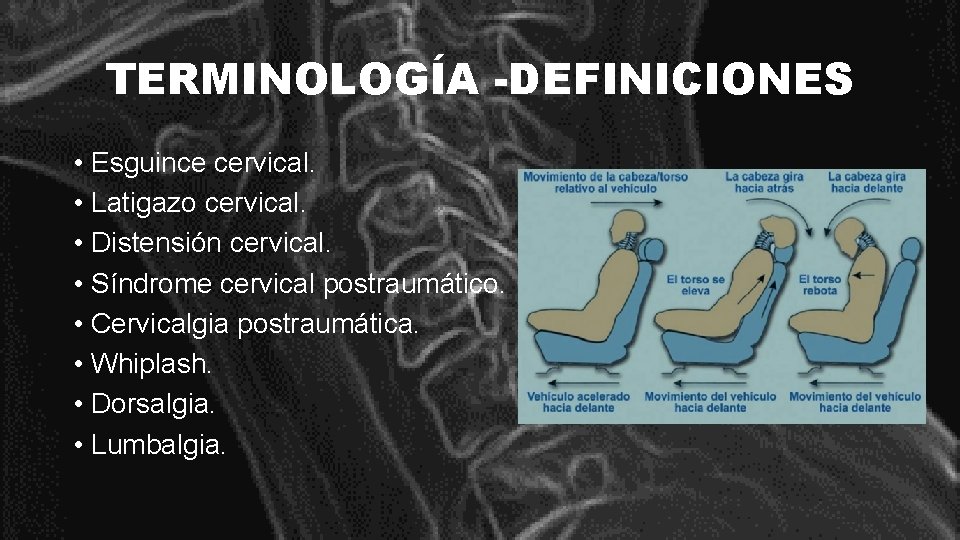 TERMINOLOGÍA -DEFINICIONES • Esguince cervical. • Latigazo cervical. • Distensión cervical. • Síndrome cervical