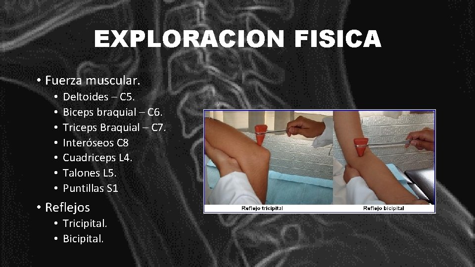 EXPLORACION FISICA • Fuerza muscular. • • Deltoides – C 5. Biceps braquial –