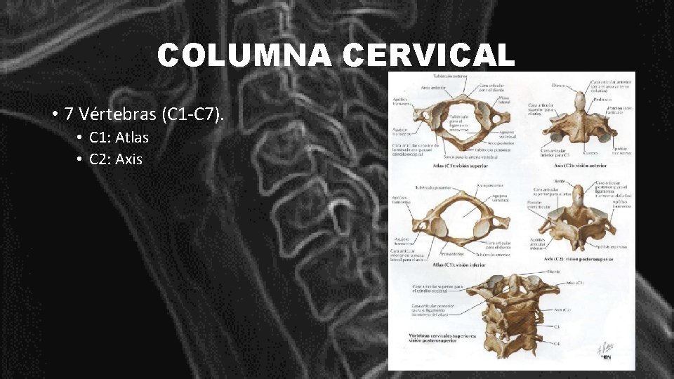 COLUMNA CERVICAL • 7 Vértebras (C 1 -C 7). • C 1: Atlas •