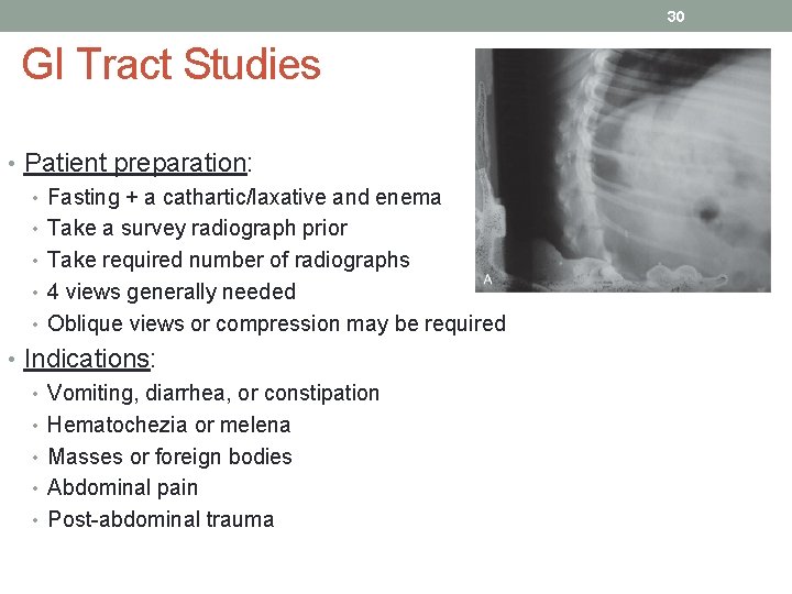 30 GI Tract Studies • Patient preparation: • Fasting + a cathartic/laxative and enema