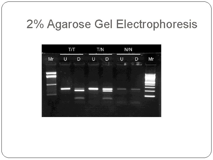 2% Agarose Gel Electrophoresis 