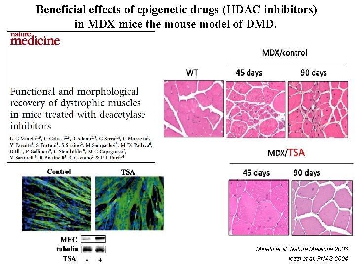 Beneficial effects of epigenetic drugs (HDAC inhibitors) in MDX mice the mouse model of