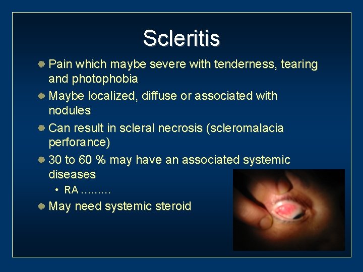 Scleritis Pain which maybe severe with tenderness, tearing and photophobia Maybe localized, diffuse or