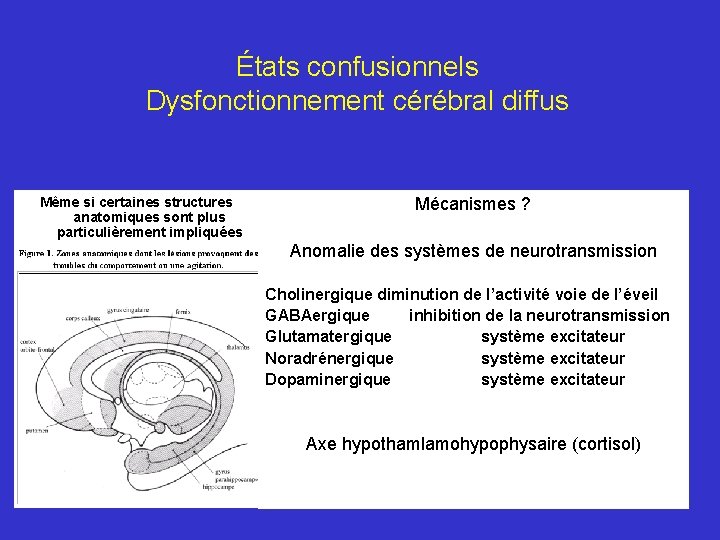 États confusionnels Dysfonctionnement cérébral diffus Même si certaines structures anatomiques sont plus particulièrement impliquées