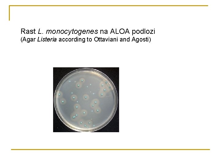 Rast L. monocytogenes na ALOA podlozi (Agar Listeria according to Ottaviani and Agosti) 