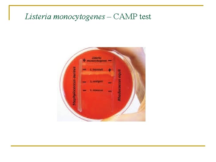 Listeria monocytogenes – CAMP test 