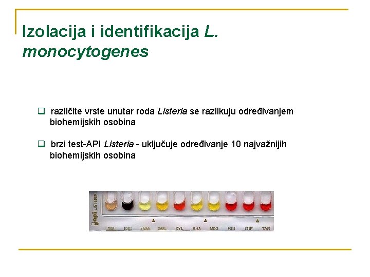 Izolacija i identifikacija L. monocytogenes q različite vrste unutar roda Listeria se razlikuju određivanjem