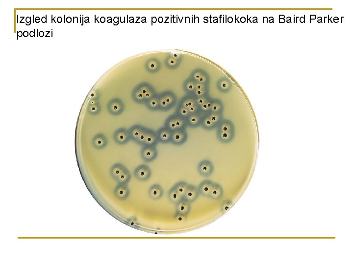 Izgled kolonija koagulaza pozitivnih stafilokoka na Baird Parker podlozi 