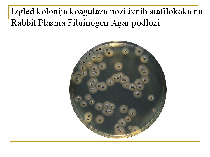 Izgled kolonija koagulaza pozitivnih stafilokoka na Rabbit Plasma Fibrinogen Agar podlozi 