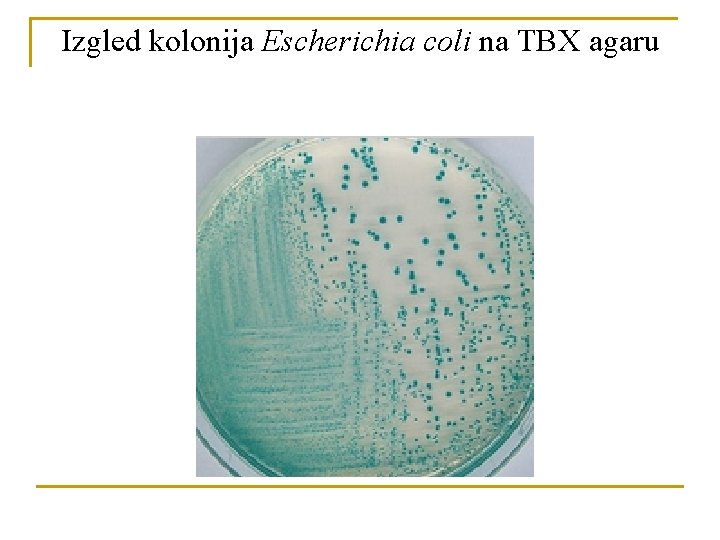 Izgled kolonija Escherichia coli na TBX agaru 