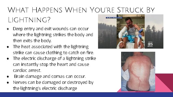 What Happens When You're Struck By Lightning? ● Deep entry and exit wounds can