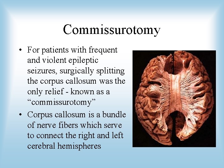 Commissurotomy • For patients with frequent and violent epileptic seizures, surgically splitting the corpus