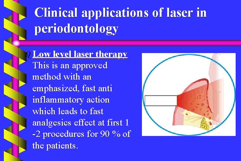 Clinical applications of laser in periodontology b Low level laser therapy This is an