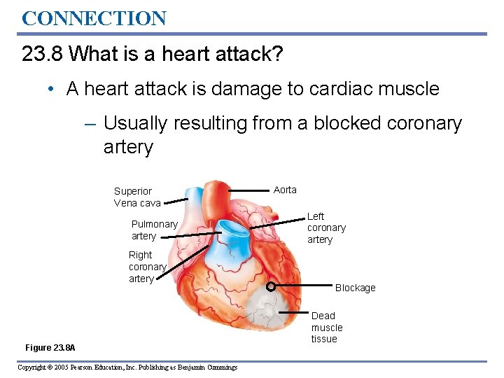 CONNECTION 23. 8 What is a heart attack? • A heart attack is damage