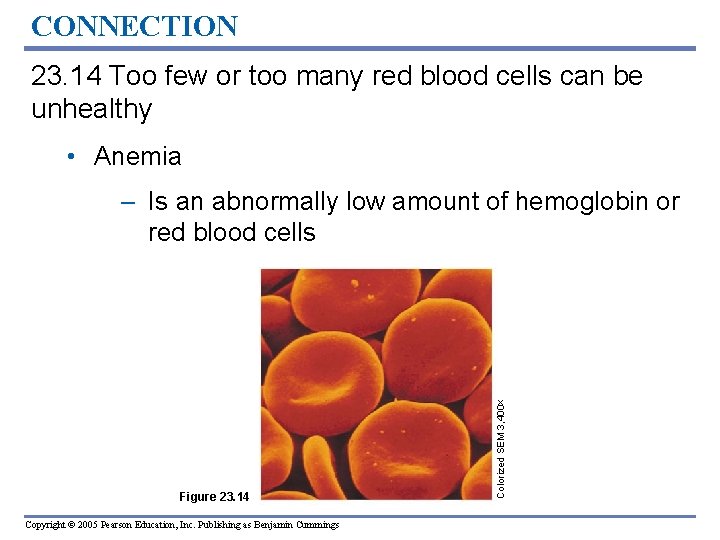 CONNECTION 23. 14 Too few or too many red blood cells can be unhealthy