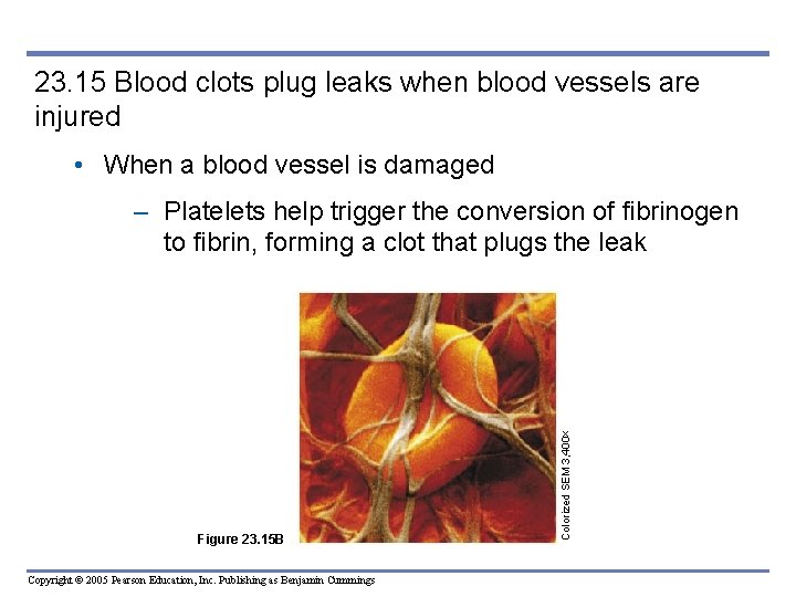 23. 15 Blood clots plug leaks when blood vessels are injured • When a