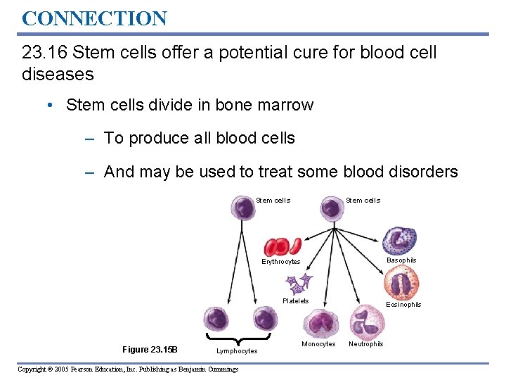 CONNECTION 23. 16 Stem cells offer a potential cure for blood cell diseases •
