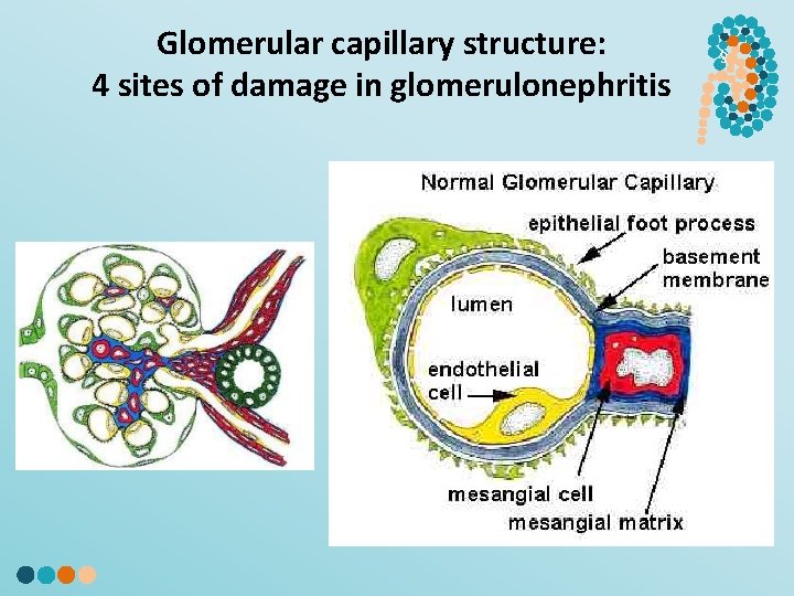 Glomerular capillary structure: 4 sites of damage in glomerulonephritis § 