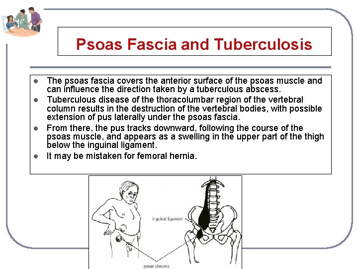 Psoas Fascia and Tuberculosis l l The psoas fascia covers the anterior surface of