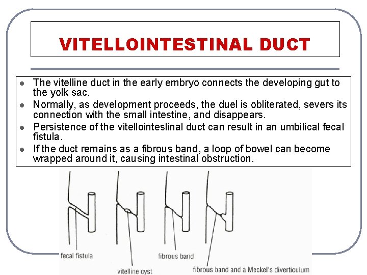 VITELLOINTESTINAL DUCT l l The vitelline duct in the early embryo connects the developing