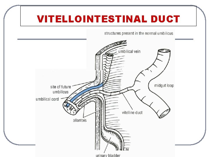 VITELLOINTESTINAL DUCT 