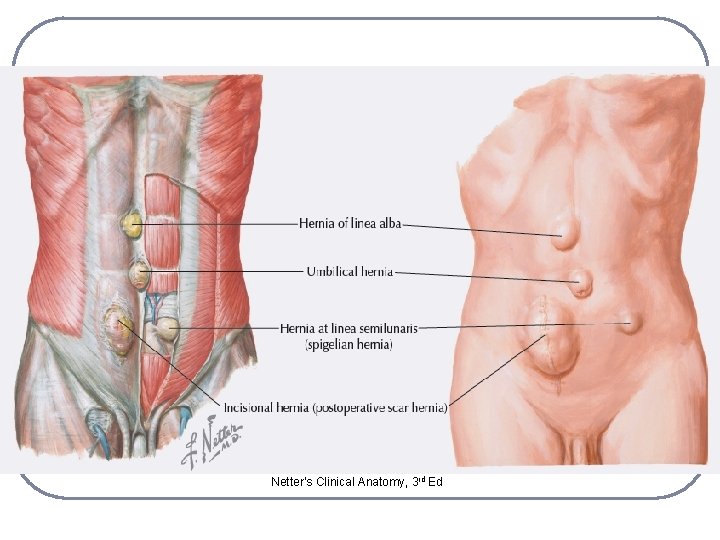 Netter’s Clinical Anatomy, 3 rd Ed 