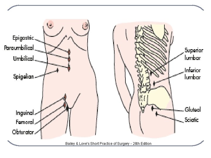 Bailey & Love’s Short Practice of Surgery - 26 th Edition 