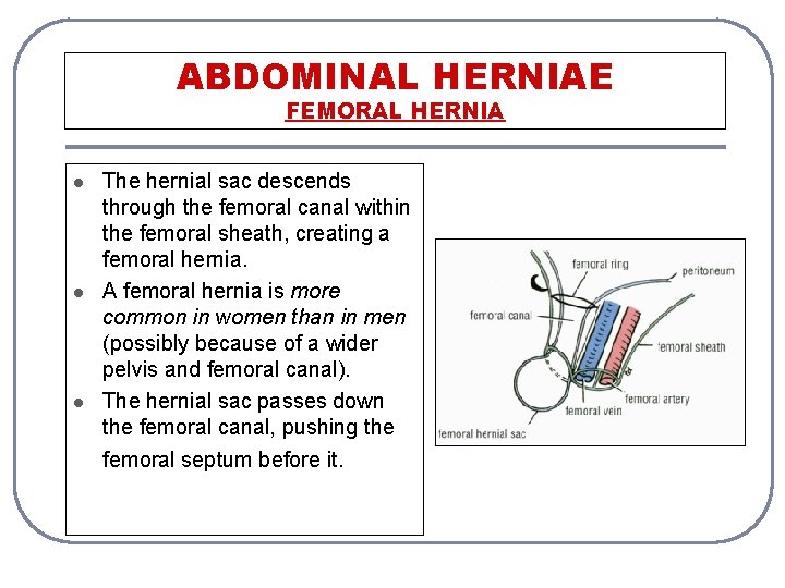 ABDOMINAL HERNIAE FEMORAL HERNIA l l l The hernial sac descends through the femoral