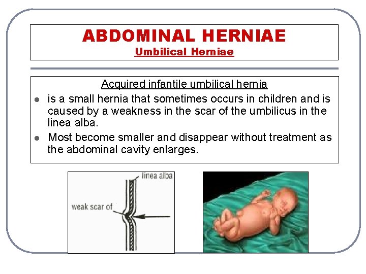 ABDOMINAL HERNIAE Umbilical Herniae l l Acquired infantile umbilical hernia is a small hernia