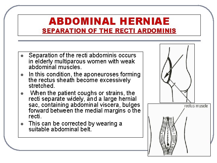 ABDOMINAL HERNIAE SEPARATION OF THE RECTI ARDOMINIS l l Separation of the recti abdominis