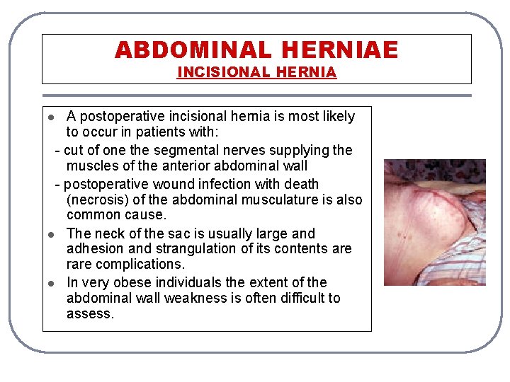 ABDOMINAL HERNIAE INCISIONAL HERNIA A postoperative incisional hernia is most likely to occur in